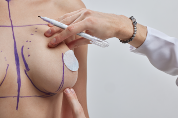 Brasil é modelo na especialização de cirurgiões de mama em técnicas oncoplásticas
